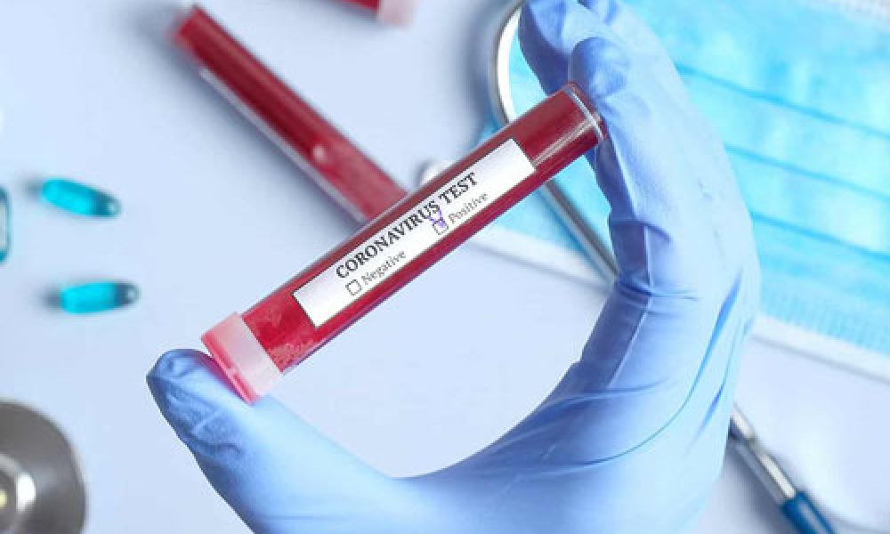 افتتاح اولین آزمایشگاه تشخیص ویروس کرونا در سمنان