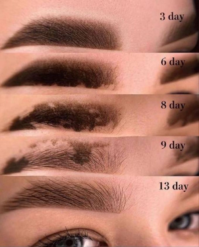 میکرو آمبره در سمنان