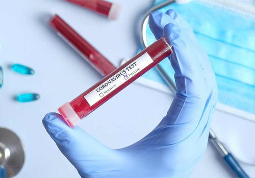 افتتاح اولین آزمایشگاه تشخیص ویروس کرونا در سمنان