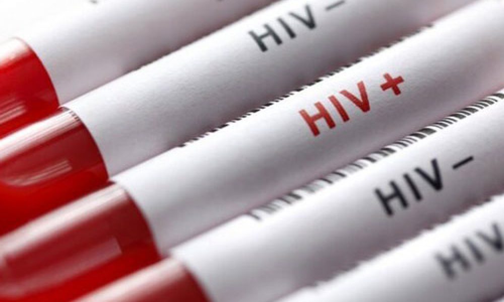 داروهای نانو، افق امیدوارکننده درمان ایدز