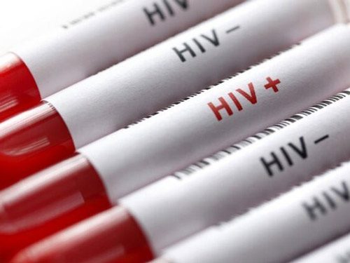 داروهای نانو، افق امیدوارکننده درمان ایدز