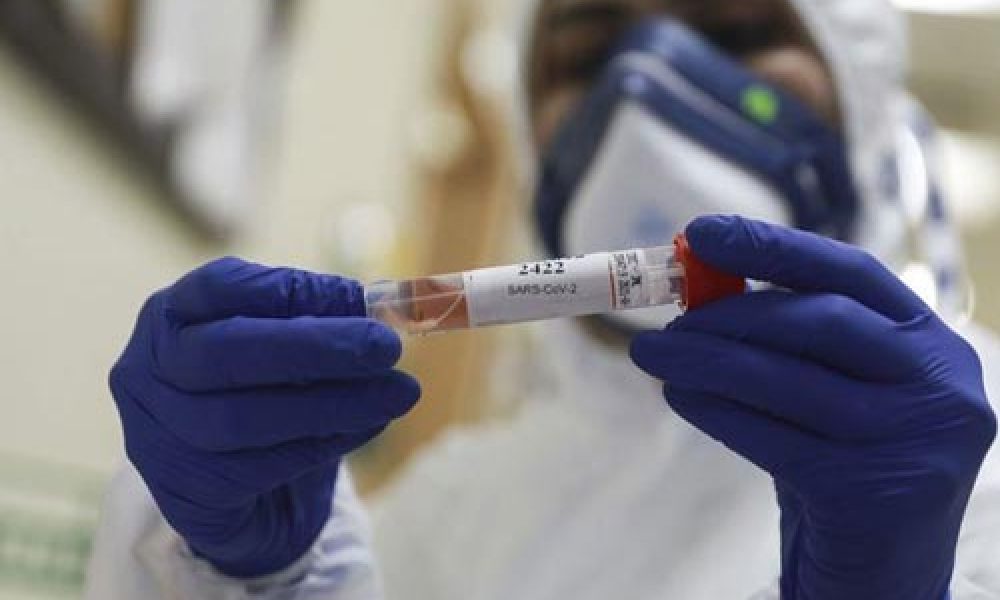 ضریب سرایت کرونا در استان سمنان چقدر است؟