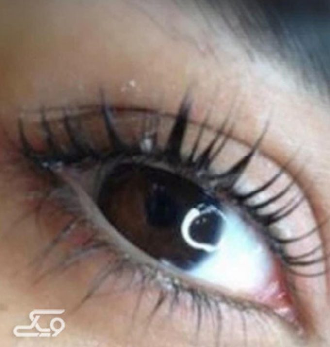 لیفت مژه